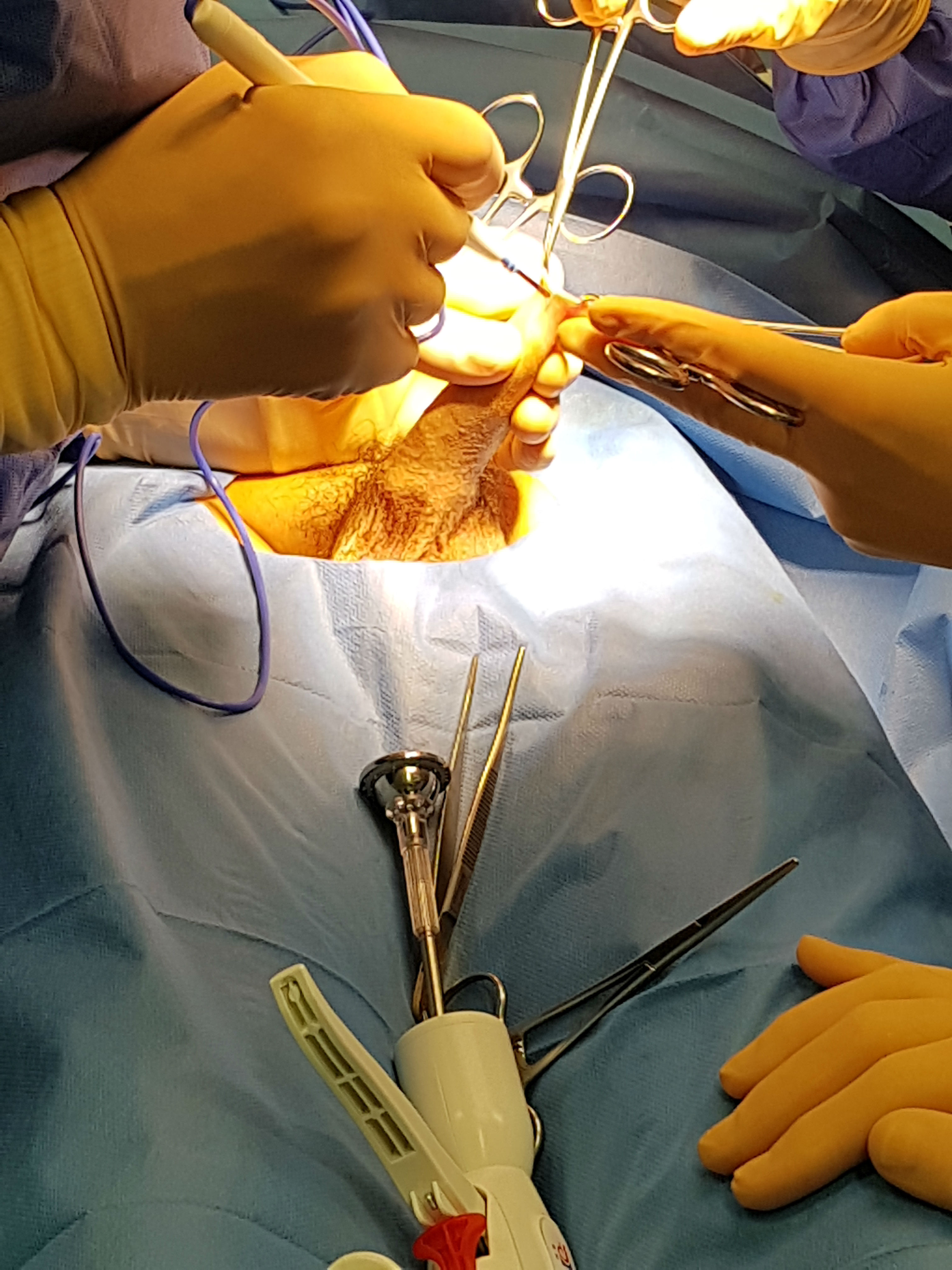 15-year-old french phimosis patient-1.jpg